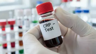 Jak interpretovat výsledky crp testu - ilustrační foto