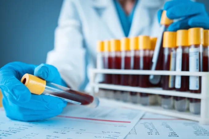 Laborant drží krevní vzorek v testovací trubičce.