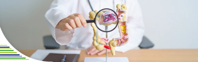 Lékař zkoumá model tlustého střeva s lupou pro diagnostiku.