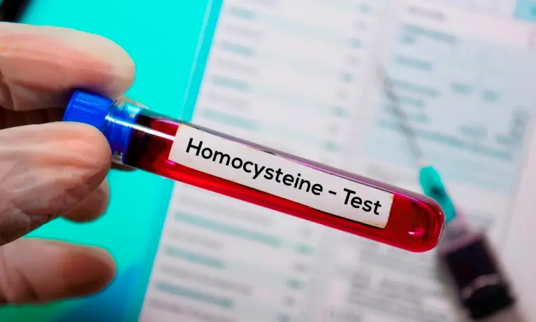 Ruka drží zkumavku s krví označenou jako test homocysteinu.