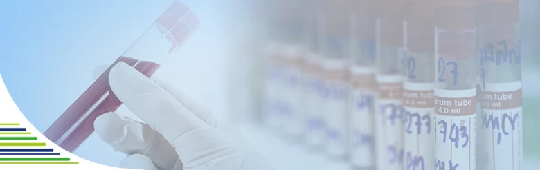 Blood test tubes in lab