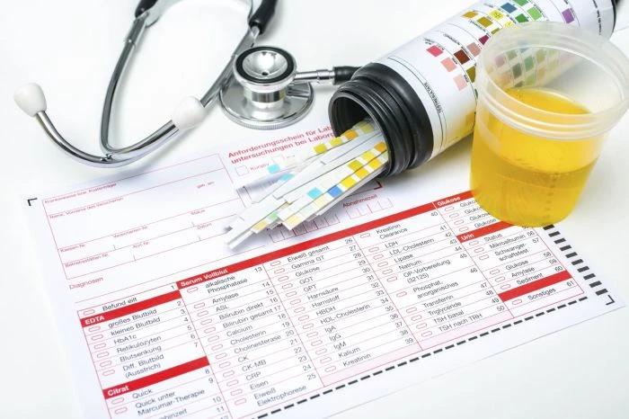 Kontejner s testovacími proužky, vzorek moči a stetoskop na formuláři.