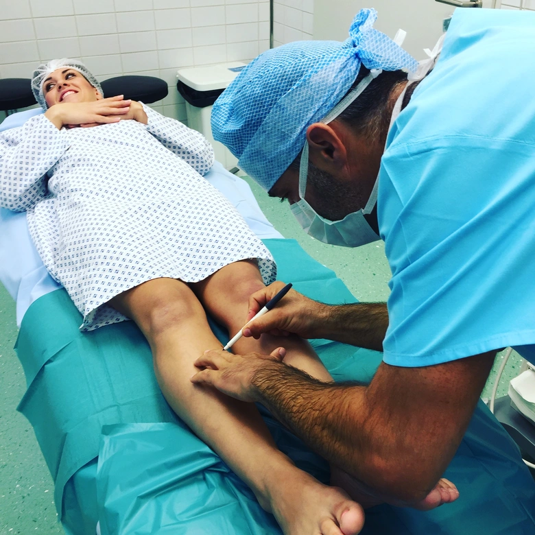 Lékař označuje křečovou žílu na stehně pacientky před léčbou.