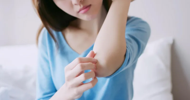 Woman scratching arm