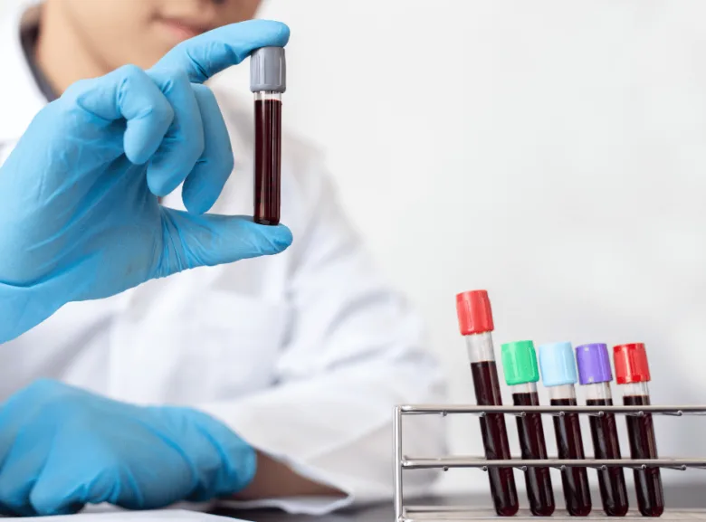 Laborant drží zkumavku s krví pro vyšetření erytrocytů