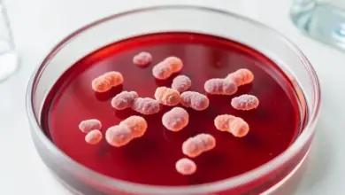 Jak se zbavit klebsiella pneumoniae a její příznaky - ilustrační foto