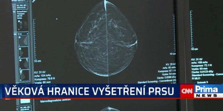Monitor s magnetickou rezonancí prsu pro diagnostiku rakoviny