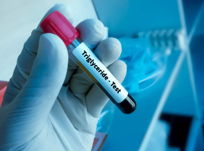 Ruka v rukavici drží zkumavku s krví pro test triglyceridů.
